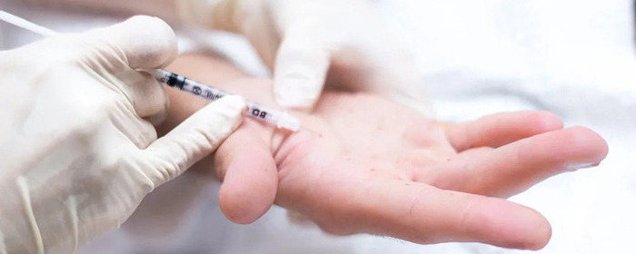 гипергидроз повышенное потоотделение лечение в Томске