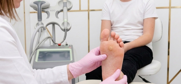 удаление бородавок лазеромв Томске