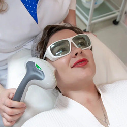 Фотоомоложение по акции