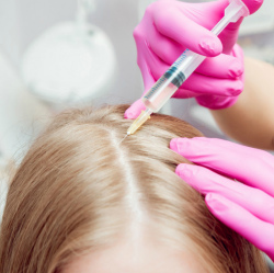 Мезотерапия - лечение выпадения волос