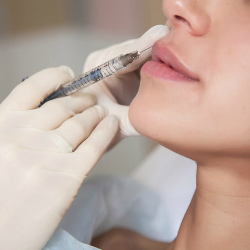 Увеличение и коррекция губ гиалуроновой кислотой