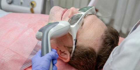 Лечение розацеа и купероза